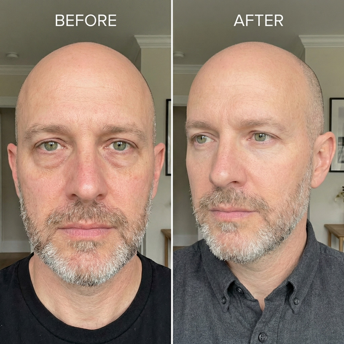 Zentifel Caffeine Booster Eye Serum